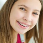 Why Is There Fast Treatment for Crooked Teeth?