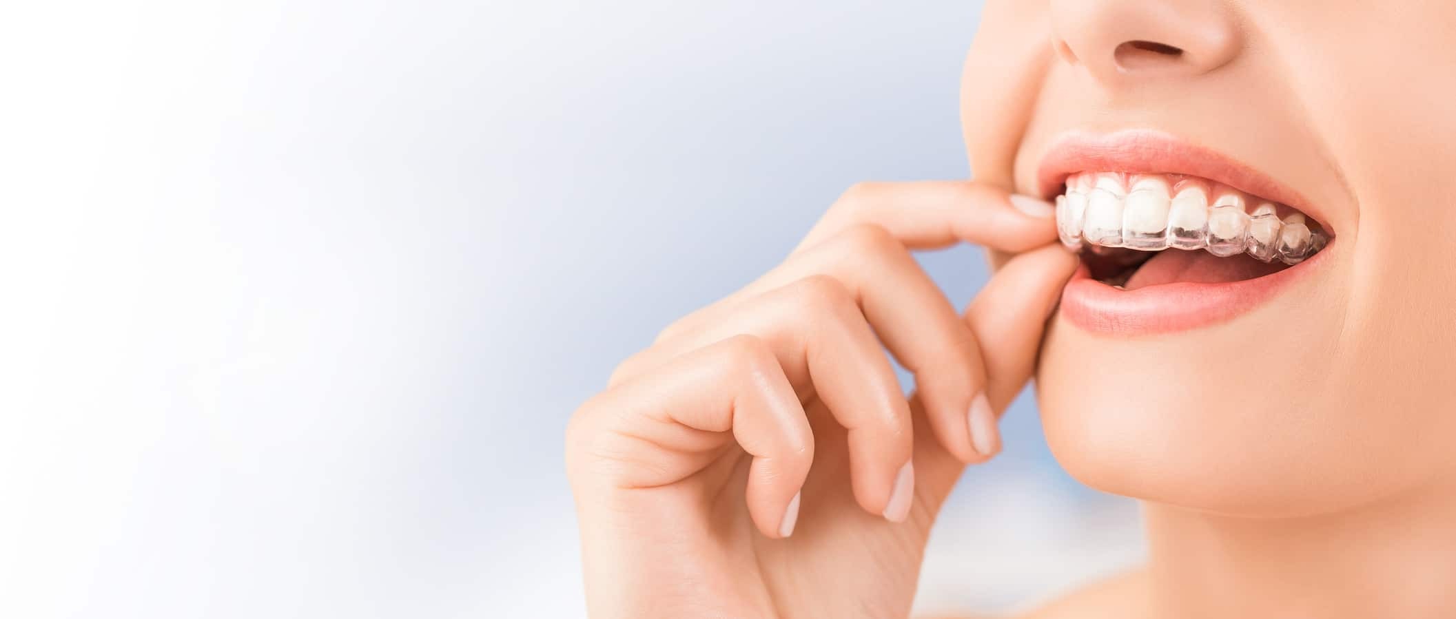 invisalign provider near me