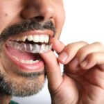 best invisalign provider near me