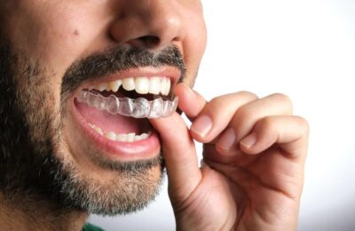 Is Invisalign Worth It? What Patients Should Know Before Starting The Treatment
