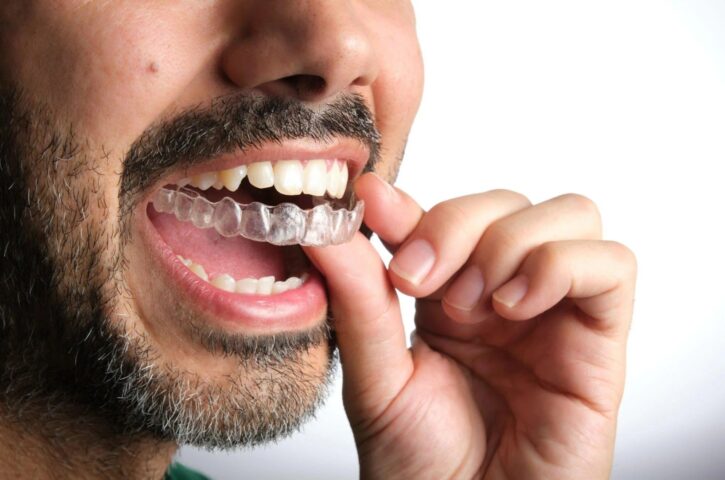 Is Invisalign Worth It? What Patients Should Know Before Starting The Treatment